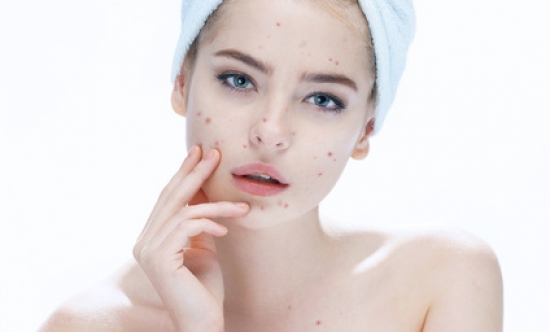 Reinheits &quot;Welle&quot;